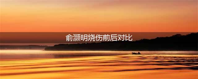 俞灏明拍戏被烧伤前后对比照，这真心让人心疼了(俞灏明烧伤前后对比)
