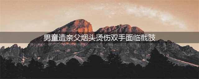 男童遭亲父烟头烫伤双手面临截肢 其父母将涉嫌构成虐待罪(男童遭亲父烟头烫伤双手面临截肢)